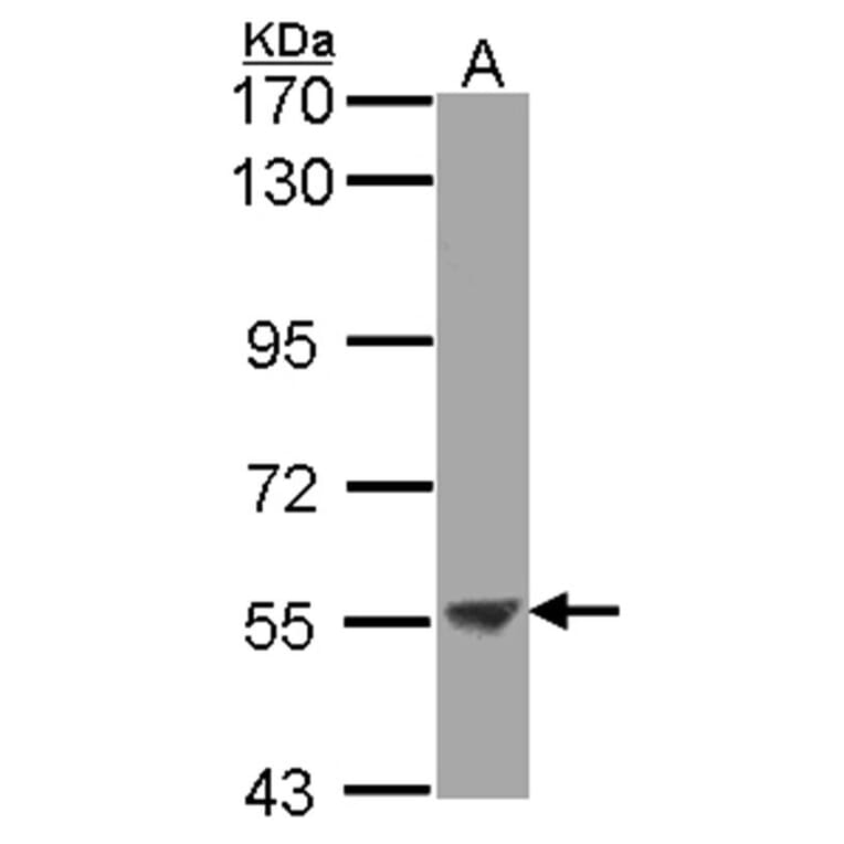 ENTPD3 antibody from Signalway Antibody (22361) - Antibodies.com