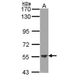 ENTPD3 antibody from Signalway Antibody (22361) - Antibodies.com