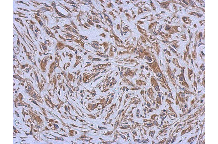 Immunohistochemistry - ENTPD3 antibody from Signalway Antibody (22361) - Antibodies.com