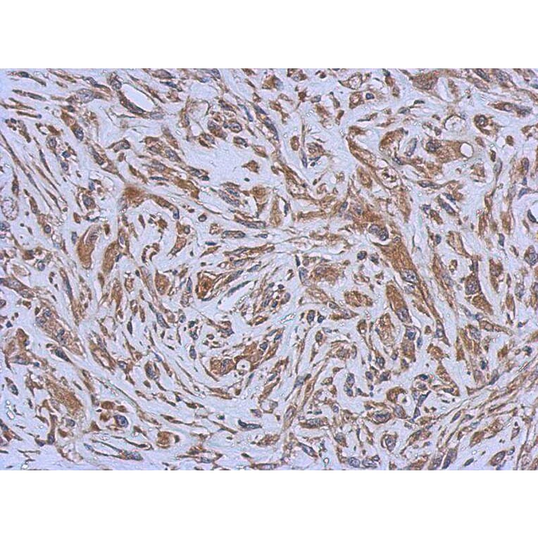 Immunohistochemistry - ENTPD3 antibody from Signalway Antibody (22361) - Antibodies.com