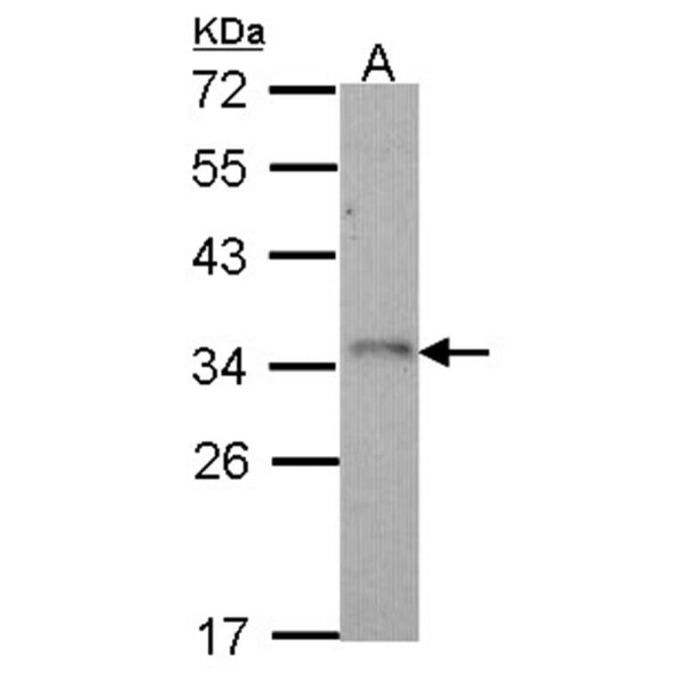 CD314 antibody from Signalway Antibody (22384) - Antibodies.com