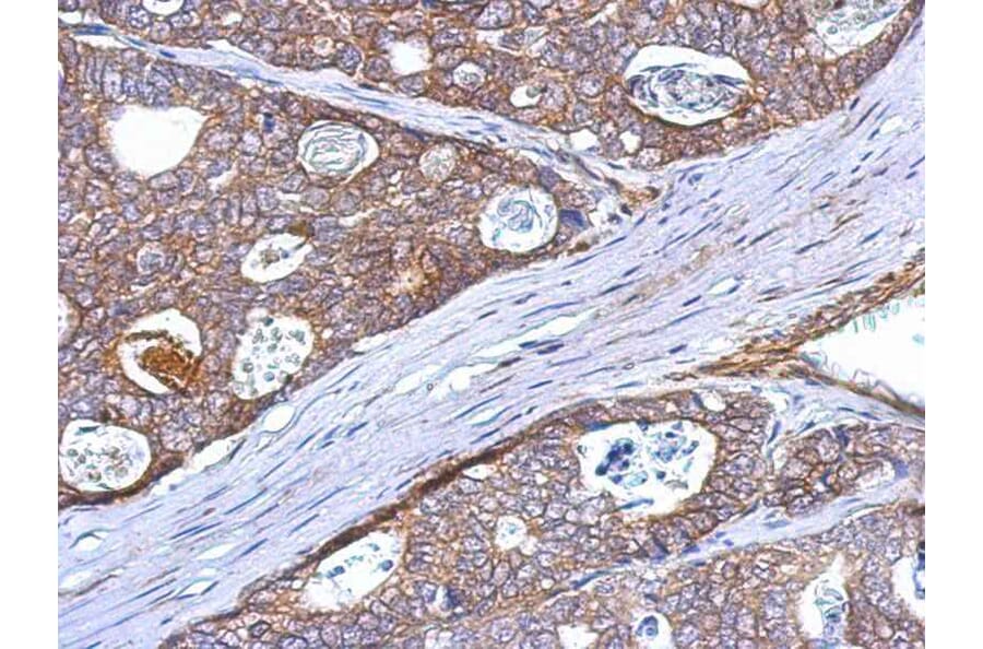 Immunohistochemistry - CD314 antibody from Signalway Antibody (22384) - Antibodies.com