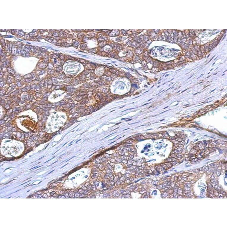 Immunohistochemistry - CD314 antibody from Signalway Antibody (22384) - Antibodies.com