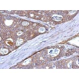 Immunohistochemistry - CD314 antibody from Signalway Antibody (22384) - Antibodies.com