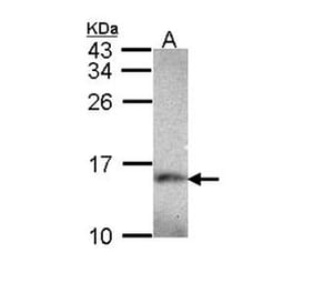 NDUFA5 antibody from Signalway Antibody (22423) - Antibodies.com