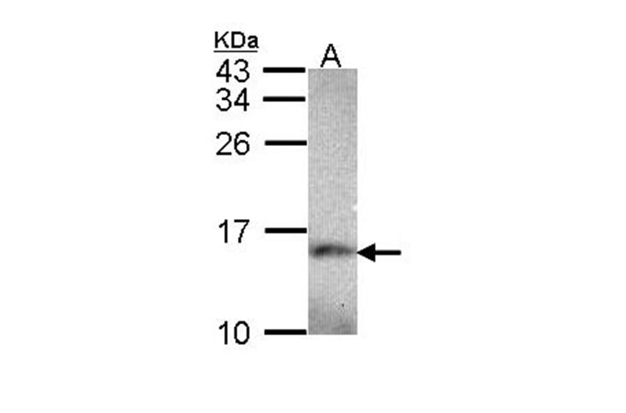 NDUFA5 antibody from Signalway Antibody (22423) - Antibodies.com