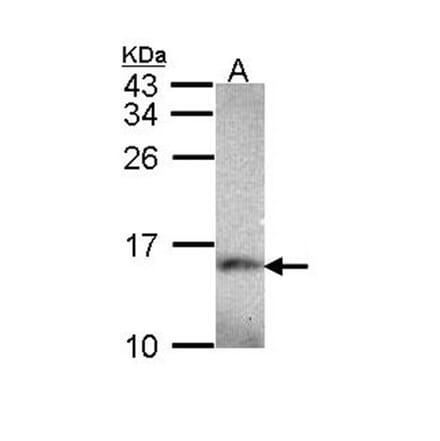 NDUFA5 antibody from Signalway Antibody (22423) - Antibodies.com