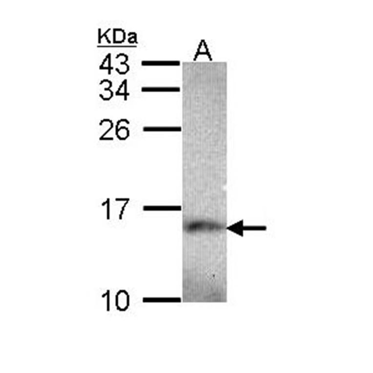 NDUFA5 antibody from Signalway Antibody (22423) - Antibodies.com