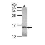 NDUFA5 antibody from Signalway Antibody (22423) - Antibodies.com