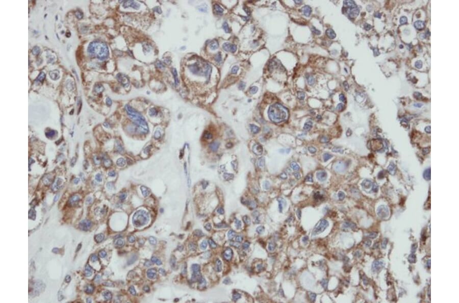 Immunohistochemistry - SAMHD1 antibody from Signalway Antibody (22479) - Antibodies.com