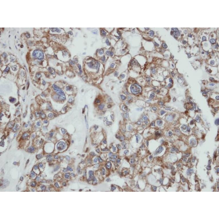 Immunohistochemistry - SAMHD1 antibody from Signalway Antibody (22479) - Antibodies.com