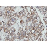 Immunohistochemistry - SAMHD1 antibody from Signalway Antibody (22479) - Antibodies.com