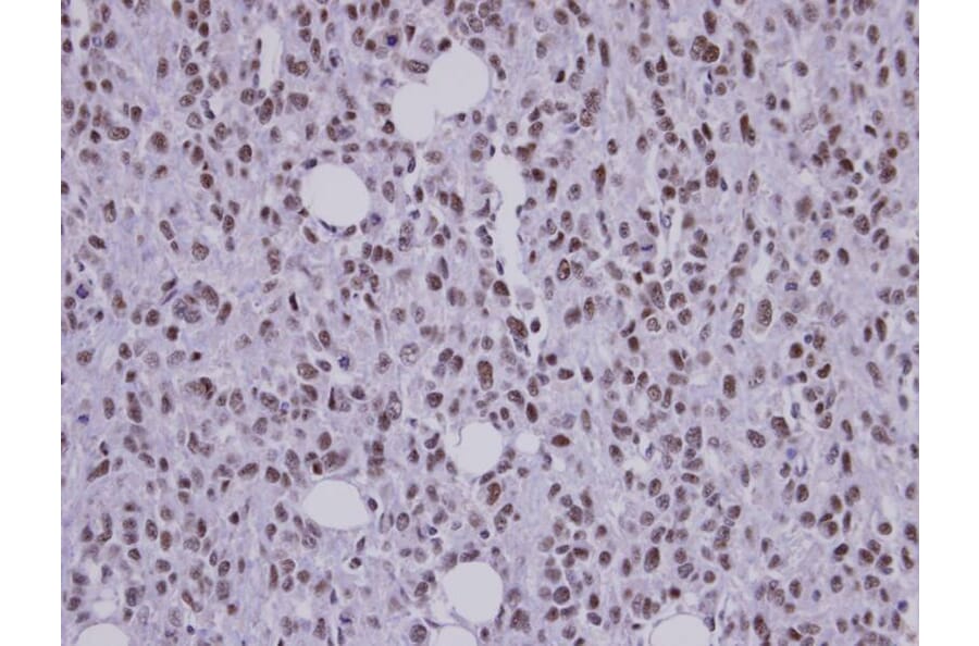 Immunohistochemistry - SAP130 antibody from Signalway Antibody (22516) - Antibodies.com
