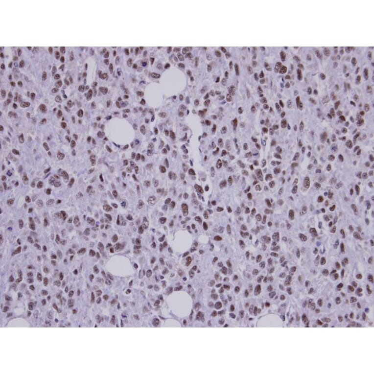 Immunohistochemistry - SAP130 antibody from Signalway Antibody (22516) - Antibodies.com