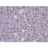 Immunohistochemistry - SAP130 antibody from Signalway Antibody (22516) - Antibodies.com