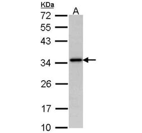 NAT-1 antibody from Signalway Antibody (22539) - Antibodies.com