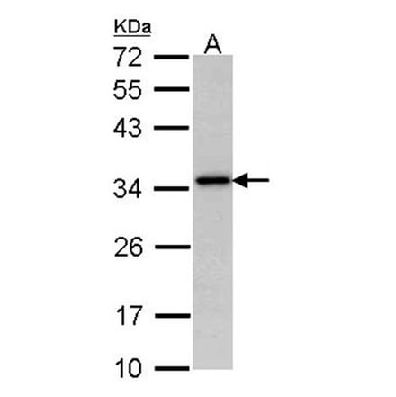 NAT-1 antibody from Signalway Antibody (22539) - Antibodies.com