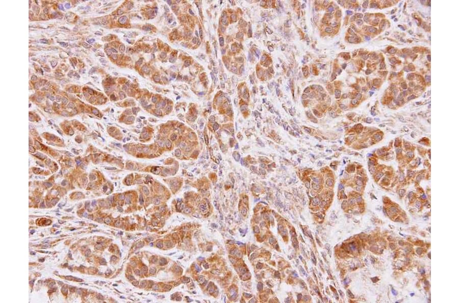 Immunohistochemistry - NAT-1 antibody from Signalway Antibody (22539) - Antibodies.com