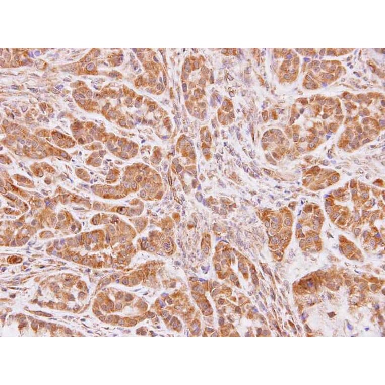 Immunohistochemistry - NAT-1 antibody from Signalway Antibody (22539) - Antibodies.com