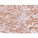 Immunohistochemistry - NAT-1 antibody from Signalway Antibody (22539) - Antibodies.com