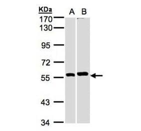 PPP3CB antibody from Signalway Antibody (22555) - Antibodies.com