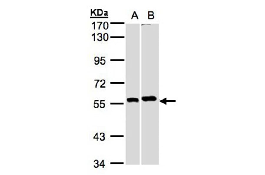 PPP3CB antibody from Signalway Antibody (22555) - Antibodies.com