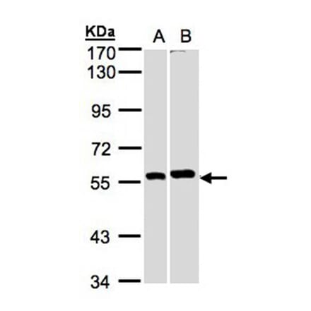 PPP3CB antibody from Signalway Antibody (22555) - Antibodies.com