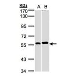 PPP3CB antibody from Signalway Antibody (22555) - Antibodies.com