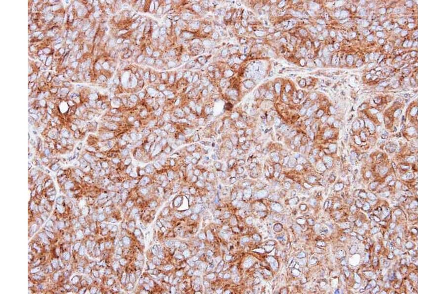 Immunohistochemistry - PPP3CB antibody from Signalway Antibody (22555) - Antibodies.com
