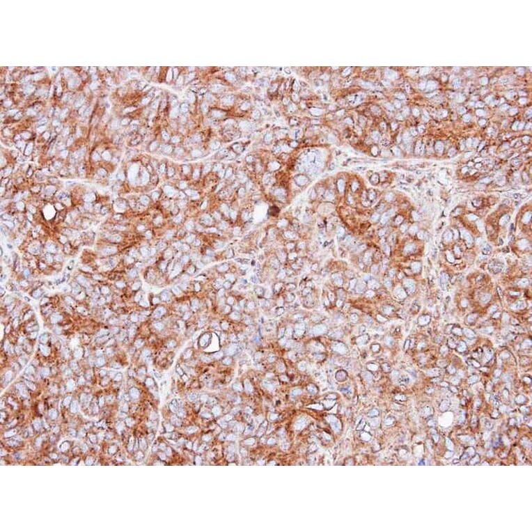 Immunohistochemistry - PPP3CB antibody from Signalway Antibody (22555) - Antibodies.com