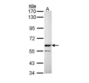 PPP3CB antibody from Signalway Antibody (22556) - Antibodies.com