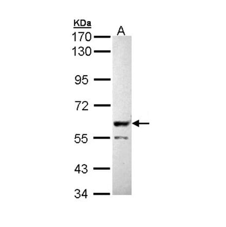 PPP3CB antibody from Signalway Antibody (22556) - Antibodies.com