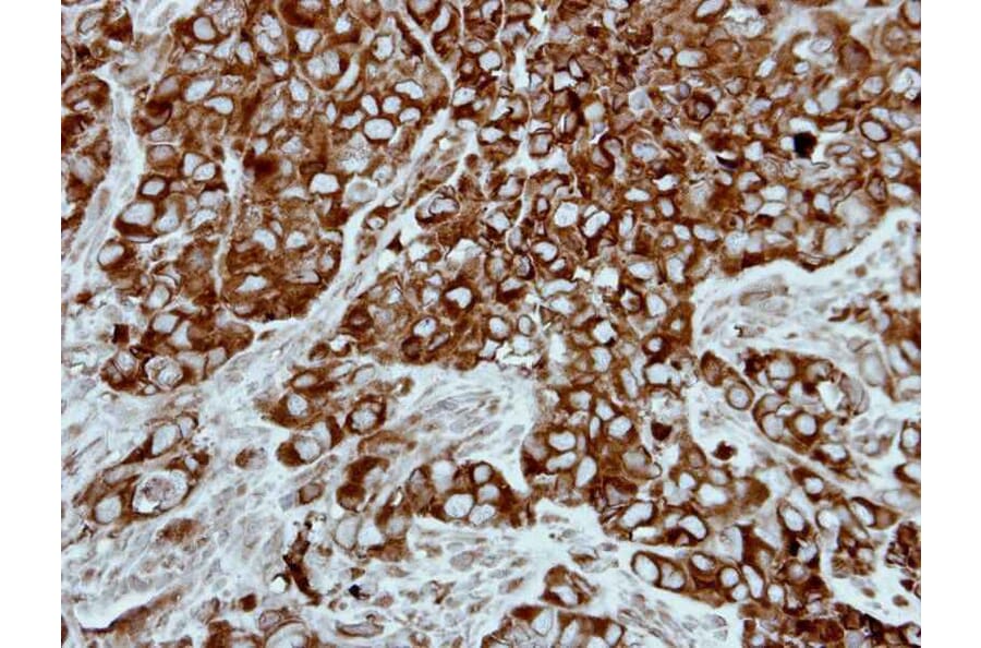 Immunohistochemistry - PPP3CB antibody from Signalway Antibody (22556) - Antibodies.com