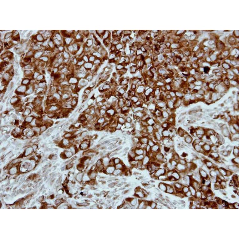 Immunohistochemistry - PPP3CB antibody from Signalway Antibody (22556) - Antibodies.com