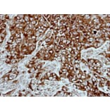 Immunohistochemistry - PPP3CB antibody from Signalway Antibody (22556) - Antibodies.com