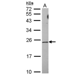 TRF4-2 antibody from Signalway Antibody (22647) - Antibodies.com