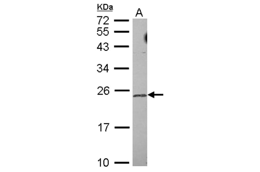 TRF4-2 antibody from Signalway Antibody (22647) - Antibodies.com