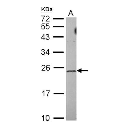 TRF4-2 antibody from Signalway Antibody (22647) - Antibodies.com