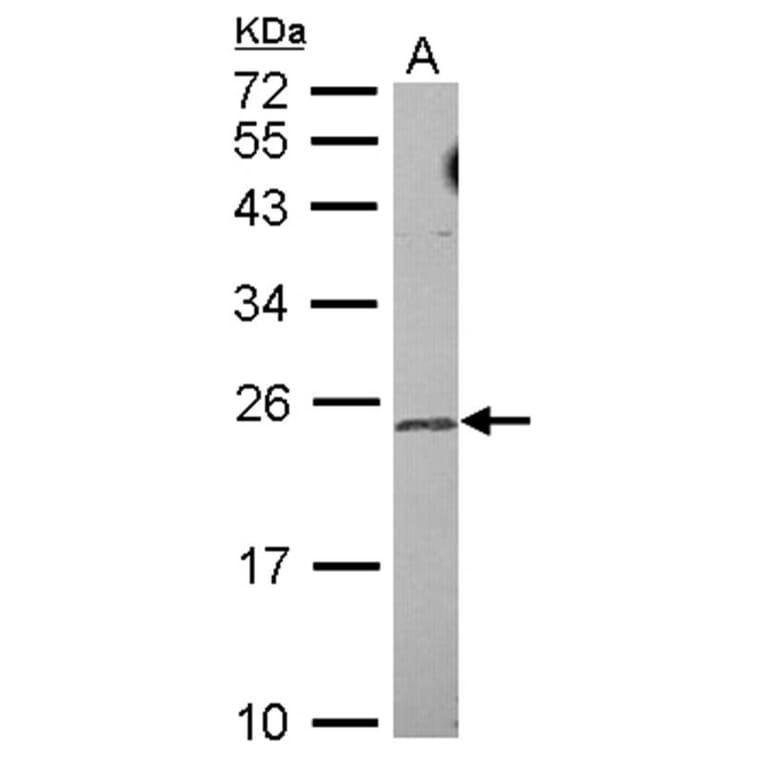 TRF4-2 antibody from Signalway Antibody (22647) - Antibodies.com