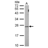 TRF4-2 antibody from Signalway Antibody (22647) - Antibodies.com
