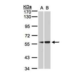 C1INH antibody from Signalway Antibody (22659) - Antibodies.com