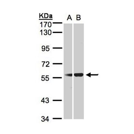 C1INH antibody from Signalway Antibody (22659) - Antibodies.com