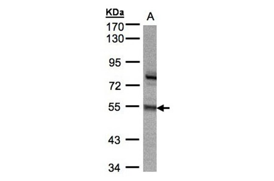 ZNF165 antibody from Signalway Antibody (22671) - Antibodies.com
