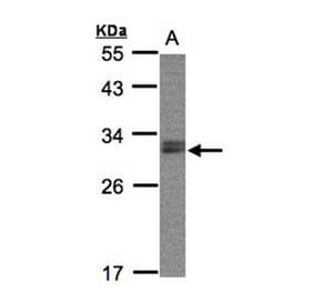 NSMCE1 antibody from Signalway Antibody (22675) - Antibodies.com