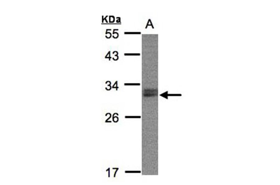 NSMCE1 antibody from Signalway Antibody (22675) - Antibodies.com
