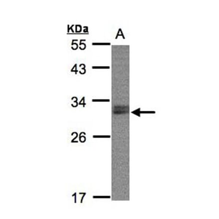 NSMCE1 antibody from Signalway Antibody (22675) - Antibodies.com