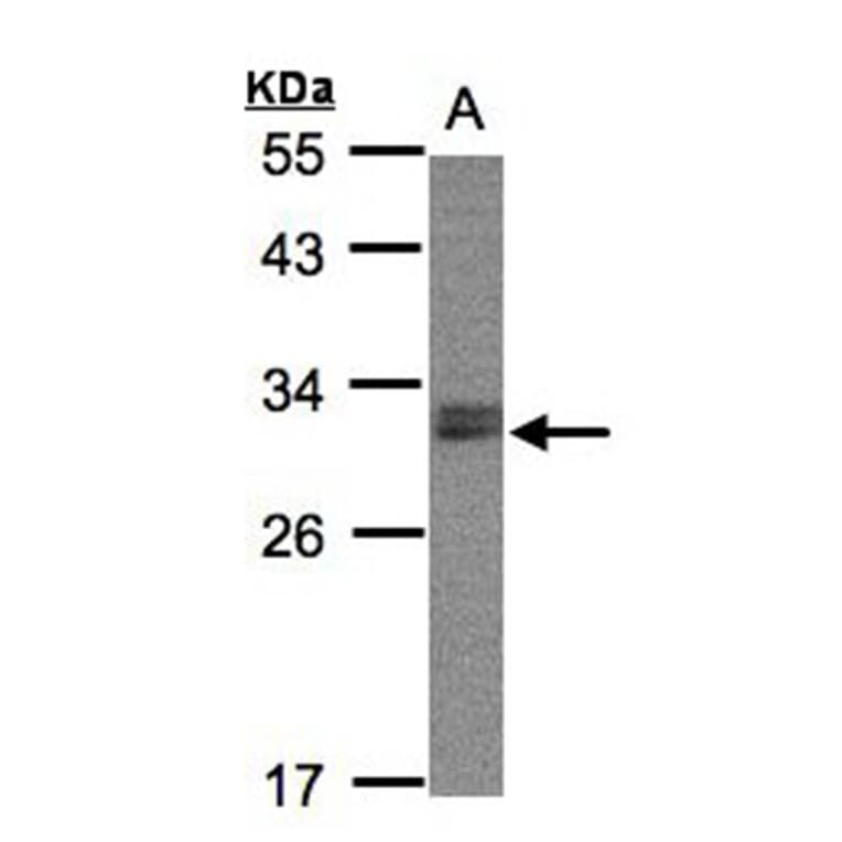 NSMCE1 antibody from Signalway Antibody (22675) - Antibodies.com