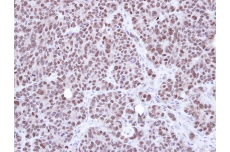 Immunohistochemistry - NSMCE1 antibody from Signalway Antibody (22675) - Antibodies.com