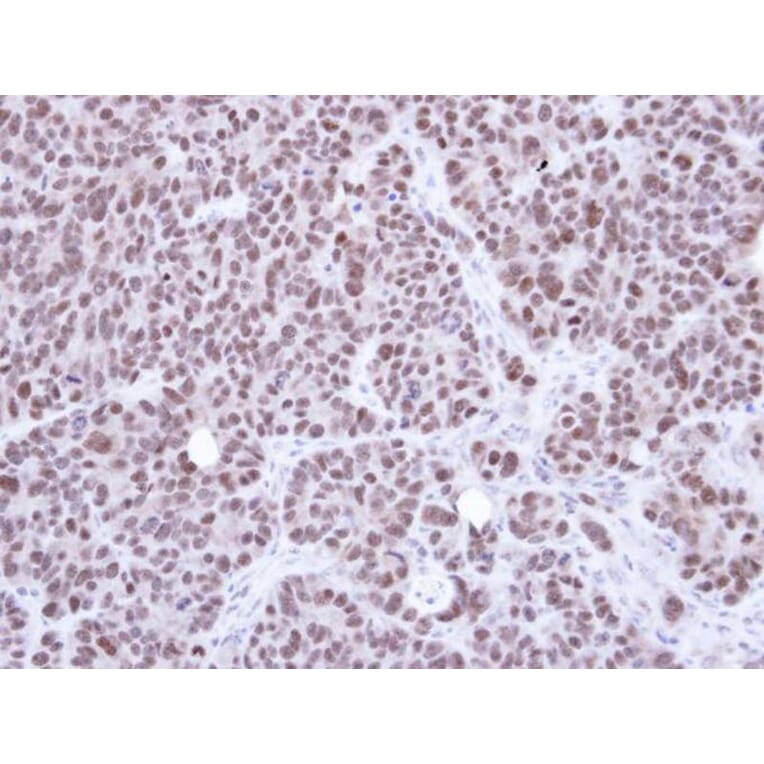 Immunohistochemistry - NSMCE1 antibody from Signalway Antibody (22675) - Antibodies.com