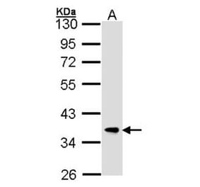 FBXL12 antibody from Signalway Antibody (22707) - Antibodies.com
